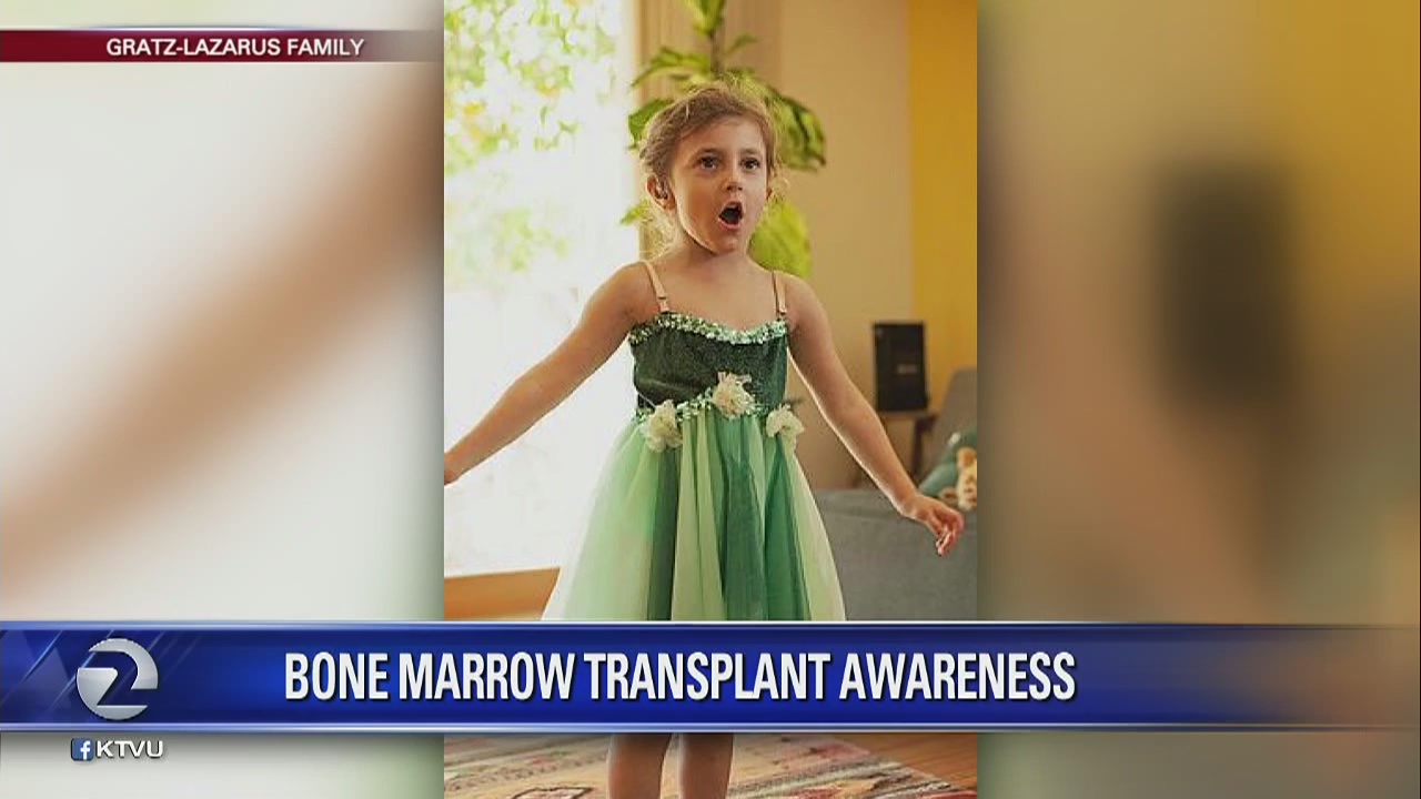 4-year-old Alameda girl diagnosed with rare genetic disorder, family urging donors to join registry